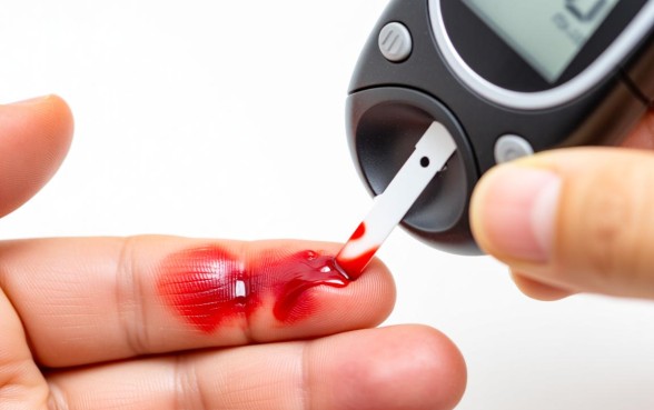 手破口子流的血能测血糖吗